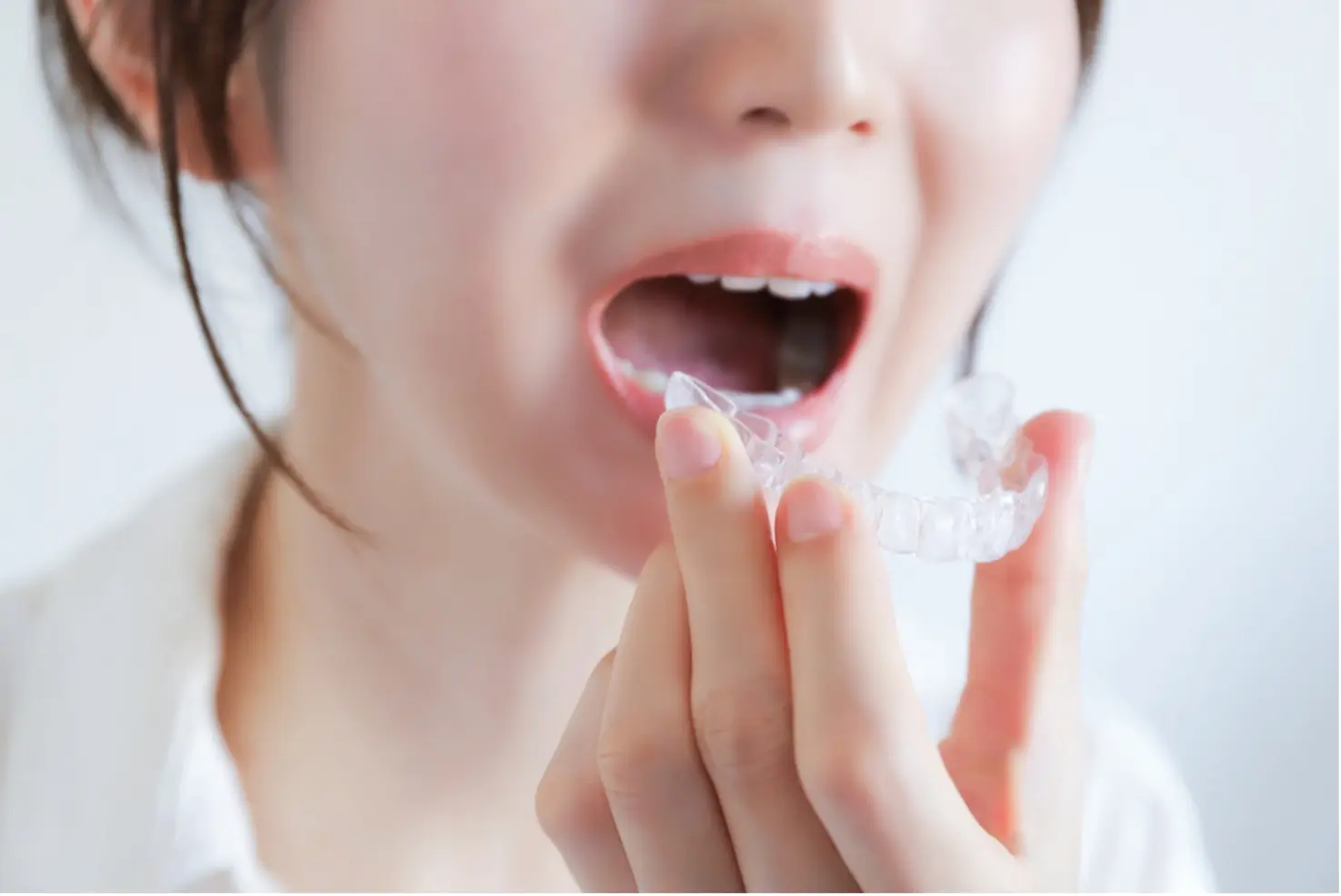 2025年最新ガイド｜今からでも間に合う！矯正歯科の治療費を上手に抑える実践テクニック